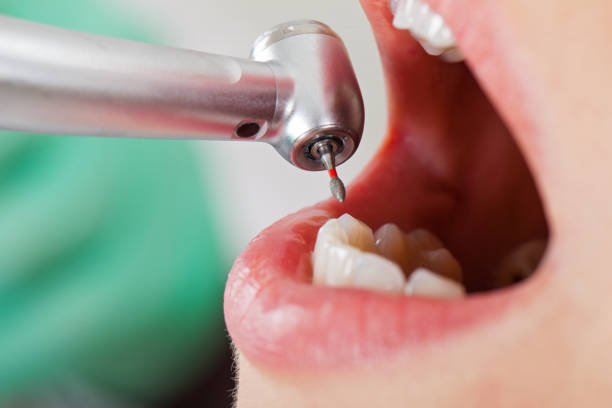 Best Emergency Dental Surgery in Green Knoll, NJ